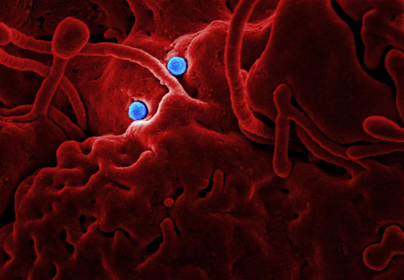 Hepatitis C Is Curable. Here's What Treatment Actually Involves