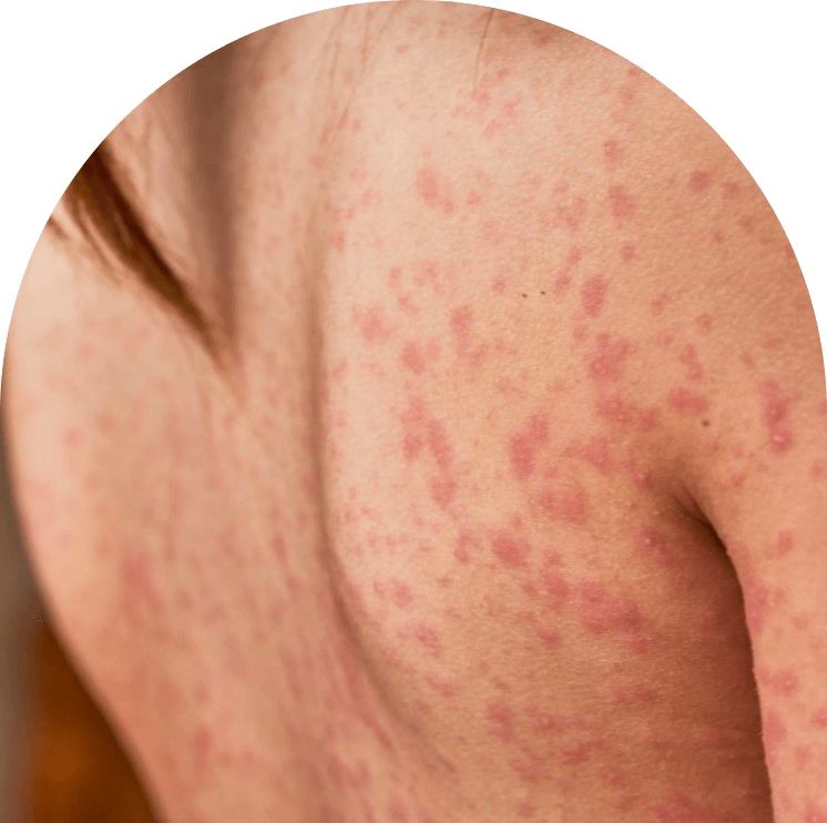 Ace Pharmacy Resource Center ace-pharmacy-resource-center